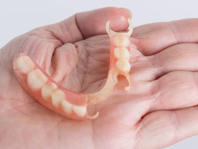 Who Benefits from Overdentures?