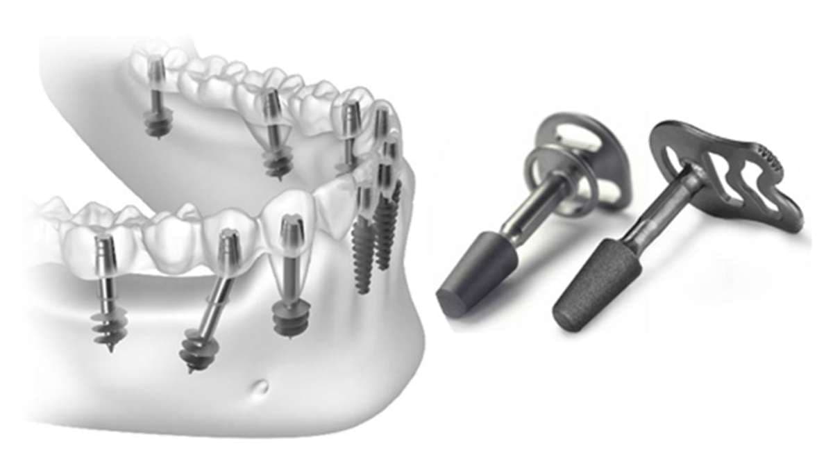 Basal Implants vs Conventional Protocol