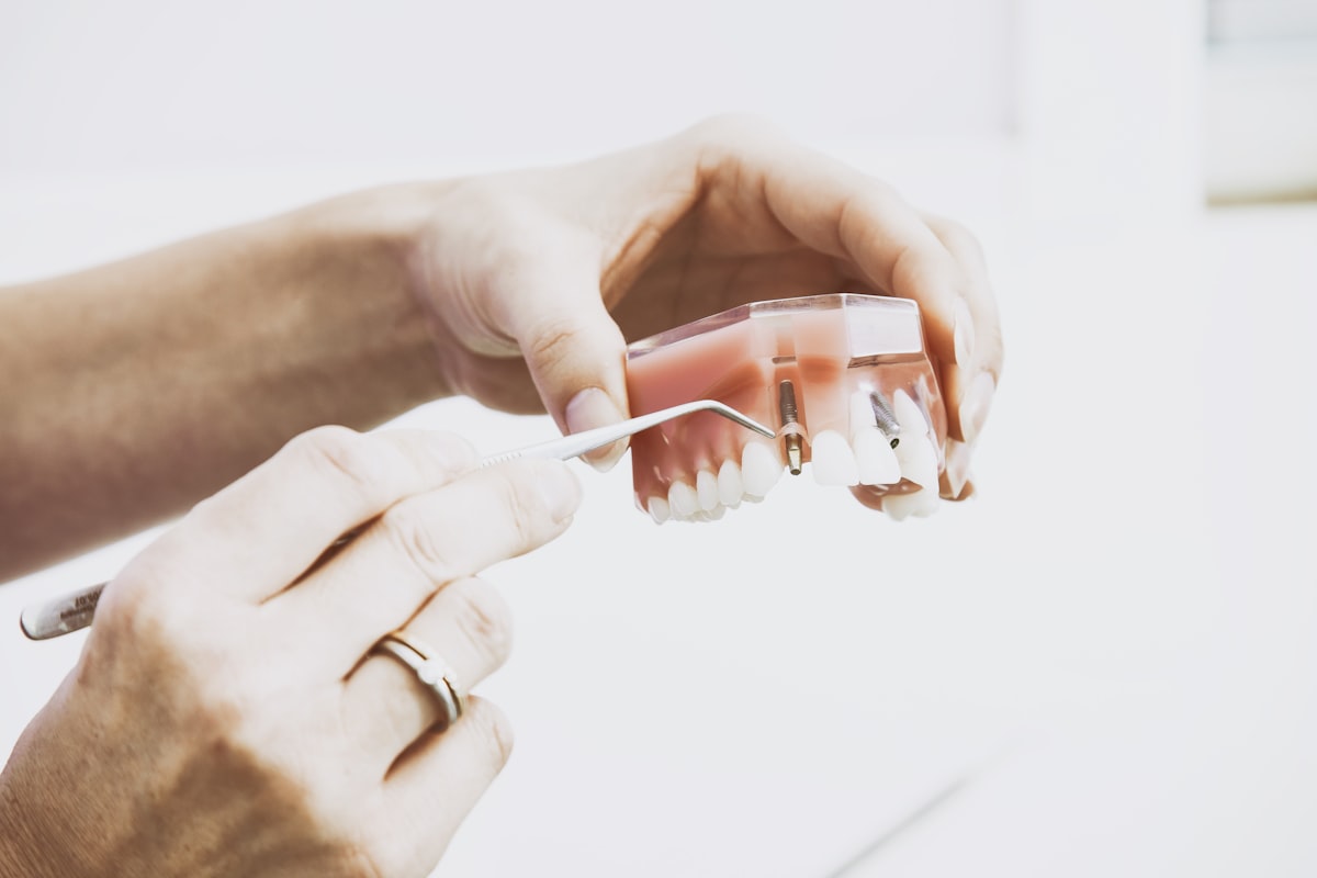 Dental prosthetic teeth on a model